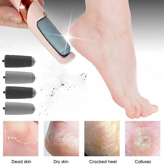 Dead skin remover