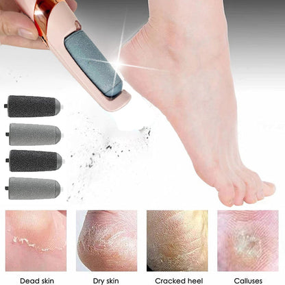 Dead skin remover