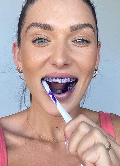 Teeth Whitening