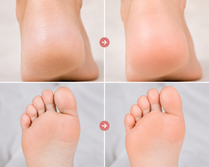 Baby powder Foot Cream